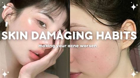 😱5 Skincare Mistakes That Make Your Acne Worse And Sensitize Your Skin