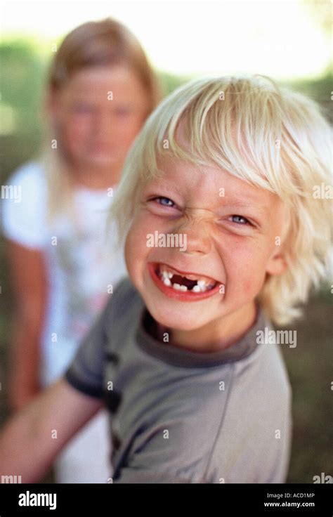 Portrait Of A Boy Without Front Teeth Stock Photo Alamy