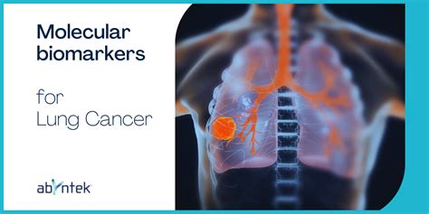 Molecular Biomarkers For Lung Cancer Abyntek Biopharma