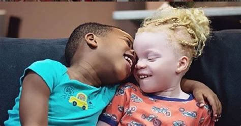 Pics Mom Of Black And White Twins Says She Thought She Was Given