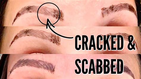 Microblading Healing Process The First Weeks In Microblading Healing Process