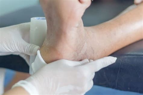 It affects the thighs, hips, buttocks and legs, causing pain and muscle wasting. Diabetic feet pictures, diabetic leg ulcers pictures ...