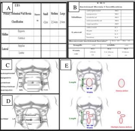 A European Hernia Society Classification Of Primary Abdominal Wall