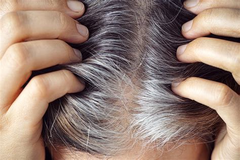 Why Does Hair Turn Gray Research Uncovers Role Of “stuck” Stem Cells