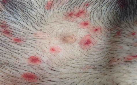 Ringworm In Dogs Is Actually Fungus It Lasts About 3 Weeks To Get Rid