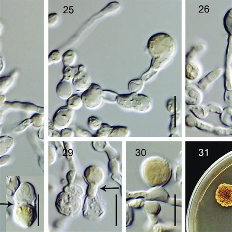 Chlamydospores And Culture Of W Atropurpurea Mea 4 Mo 25 C 24 30