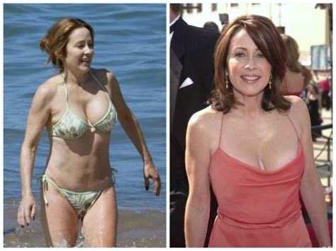 Patricia Heaton Plastic Surgery Before And After Photos Celeblens Com