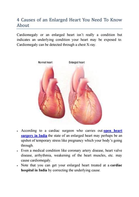 Reasons For An Enlarged Heart