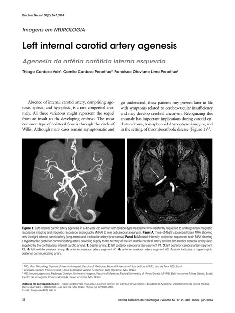 Pdf Left Internal Carotid Artery Agenesis