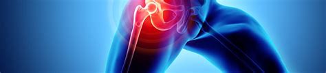 Best Total Hip Replacement Surgery In Hyderabad Virinchi Hospitals