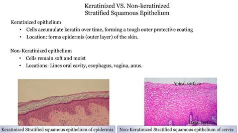Stratified Squamous Epithelium Keratinized Vs Non Keratinized