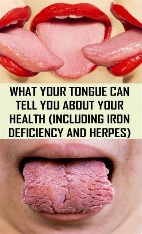 what your tongue can tell you about your health healthy tongue health health healthy