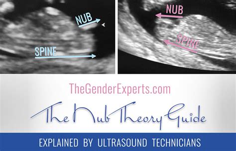 Confirmed Nub Theory The Nub Techs Nub Theory Early Gender Prediction Nub 12 Weeks Nub