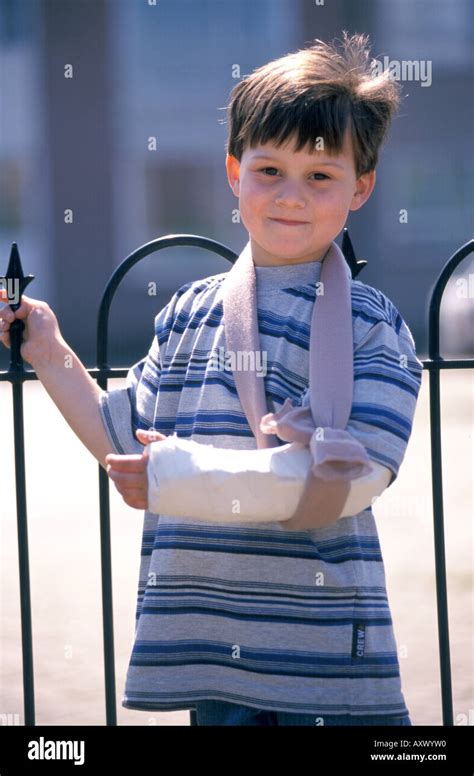 Boy With A Broken Arm Stock Photo Alamy