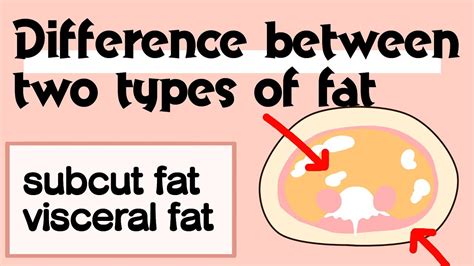04en Difference Between The Roles Of Visceral Fat And Subcutaneous
