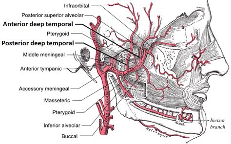 Temporal Arteritis Giant Cell Arteritis Physiopedia