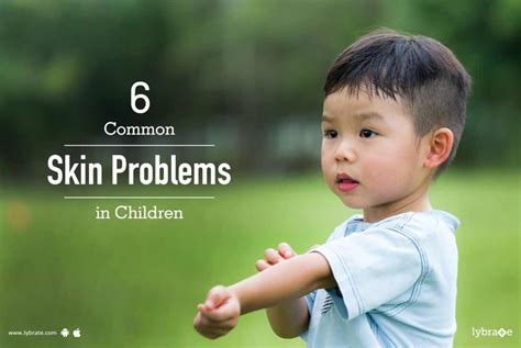 6 Common Skin Problems In Children By Dr Dharamvir Singh Lybrate