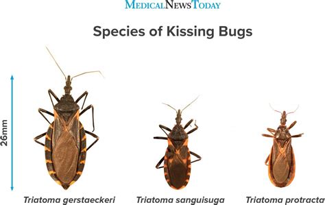 Kissing Bug Bites Symptoms Risks And Treatments The Medi Info