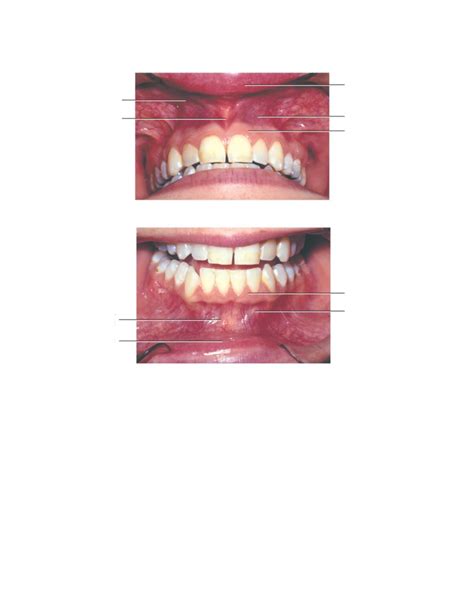 Dental Assisting Ch 10 Faceand Oral Cavity Diagram Quizlet