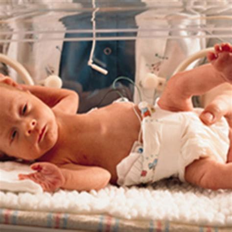 Aap Offers Guidance On Preterm Infants With Suspected Or Proven Early Onset Bacterial Sepsis