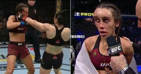 Scary Images Of Joanna Jedrzejczyk After The Fight Revealed