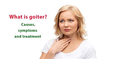 Goiter Treatment At Home Goiter And Its Natural Treatment In Nigeria