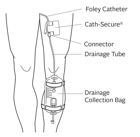 Caring For Your Urinary Foley Catheter Memorial Sloan Kettering