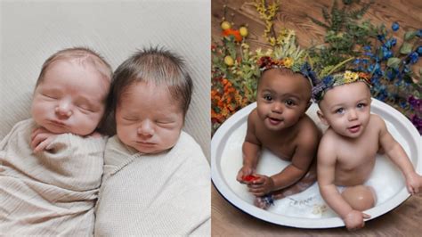 Tak Hanya Kembar Identik Ternyata Ada 7 Jenis Bayi Kembar Dalam Dunia