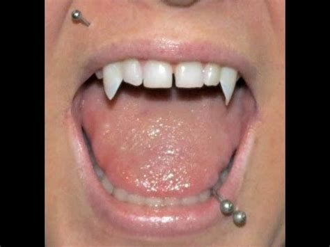 How to get vampire teeth at the dentist. Halloween Series 2013: D.I.Y. Vampire Fangs - YouTube