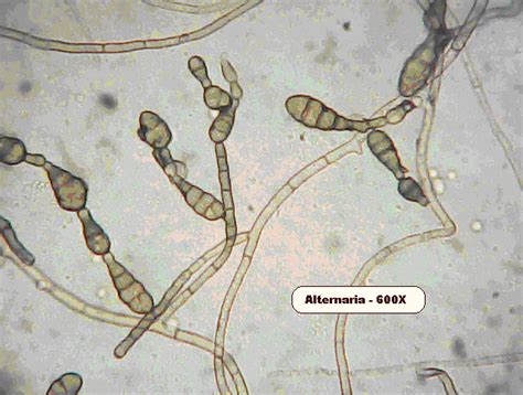 Maybe you would like to learn more about one of these? Mold under a Microscope | Create Your Healthy Home