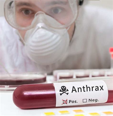 Anthrax Causes Treatments And Risks