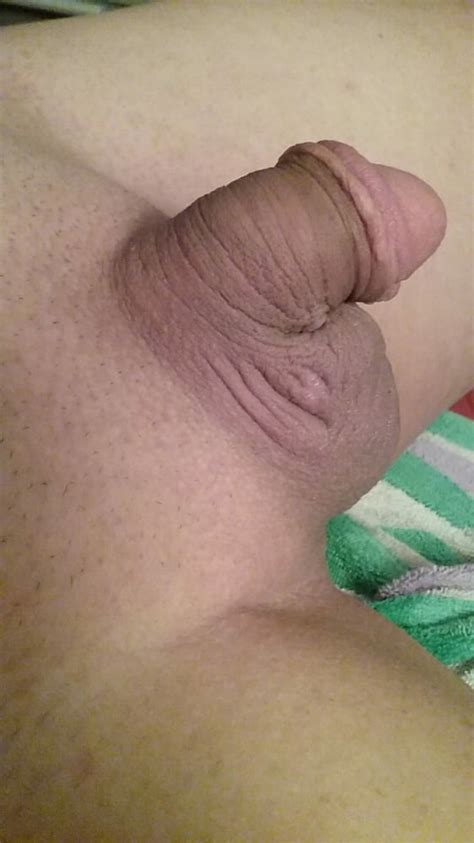 My Circumcised Penis New Pics 11 Pics Xhamster