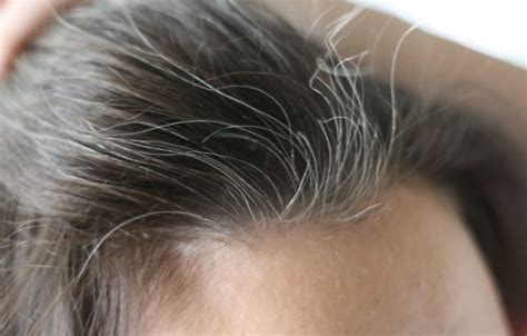 There are multiple causes that contribute to hair aging, each of them playing their own specific roles for targeting melanin in their own manner. How to Get Rid of White Hair Naturally, Permanently on ...