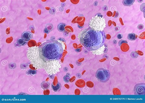 T Cells Attack Acute Myeloid Leukemia Aml Cells In Blood Flow