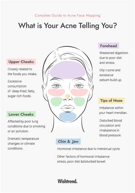 Pimple Face Mapping Face Mapping Acne Face Acne Acne Skin Facial