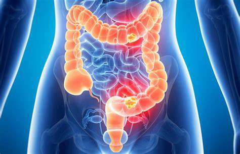 Бактерии кишечника влияют на мозг человека Картинка - Бактерии кишечника влияют на мозг человека