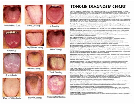 Pin By Wiktoria On Tcm Consitution Tongue Health Traditional Chinese