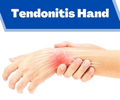 Tendonitis Hand Treatment In Pune Archives The Prolotherapy Clinic