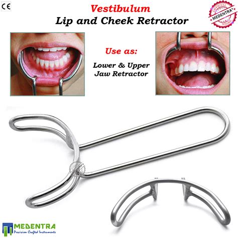 Vestibulum Cheek And Lip Retractor Dental Surgical Instrument Labial Retractors Ebay