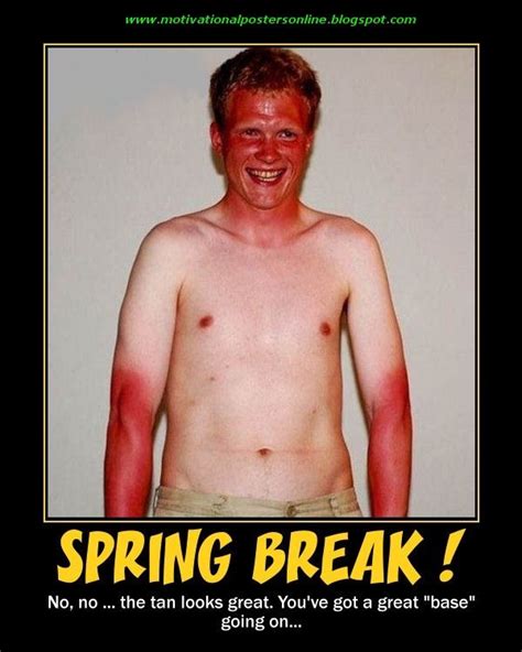 Funny Spring Bing Images Funny Sunburn Ginger Jokes Bad Sunburn