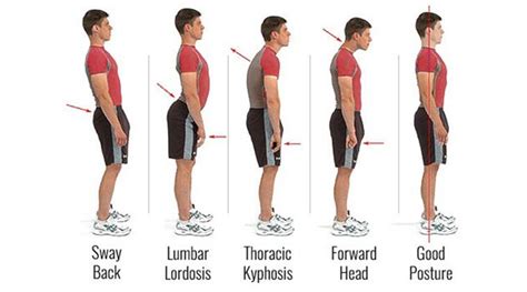 Posture Perfect Are You Standing The Right Way Lifestyle News The