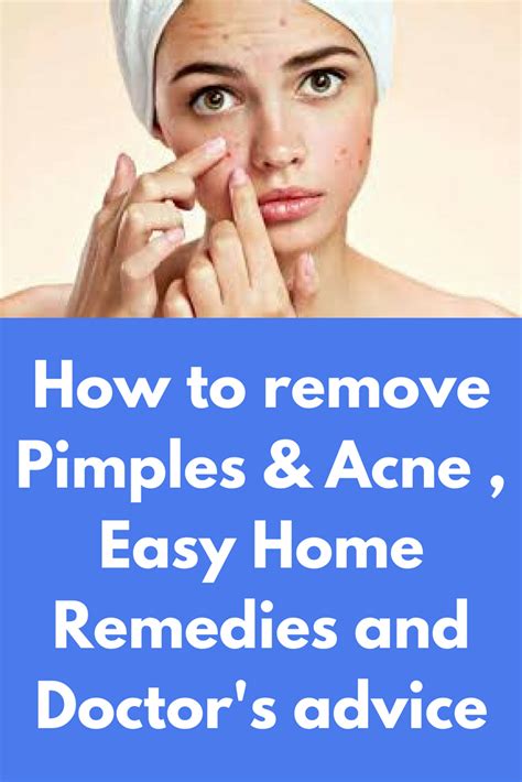 How To Remove Pimples And Acne Easy Home Remedies And Doctors Advice