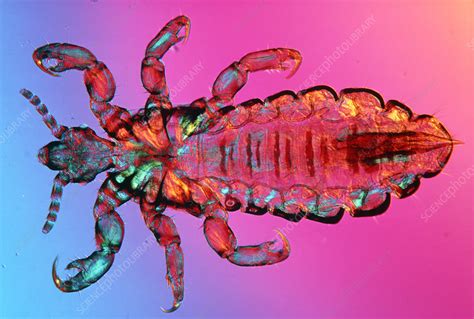 Lm Of Male Human Head Louse Stock Image Z2650046 Science Photo