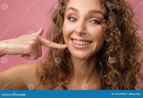 Happy Girl With Curly Hair And Dental Braces Stock Image Image Of Dentistry Closeup 163129823