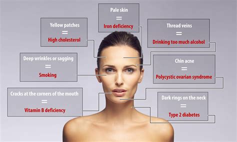 White Patches On Face Vitamin Deficiency Treatment