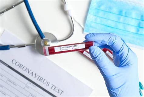 Wondering where to get tested for coronavirus? More suspected COVID-19 cases test negative in Armenia | ARMENPRESS Armenian News Agency