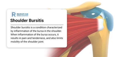 Shoulder Bursitis Treatment In New Jersey Redefine Healthcare