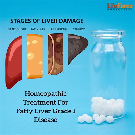 Best Homeopathic Treatment For Fatty Liver Grade 1 Disease