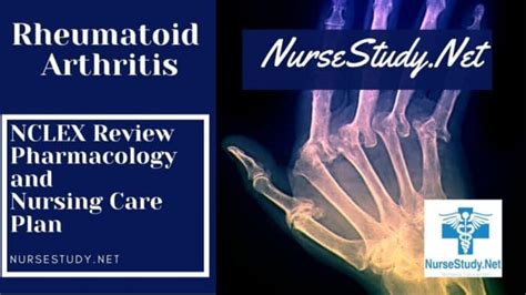 Rheumatoid Arthritis Nursing Diagnosis And Nursing Care Plan