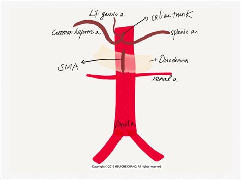 Sonoanatomy Aorta Celiac Trunk Sma Renal Artery Pocus Academy